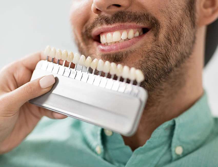 Patient Porcelain Dental Veneers